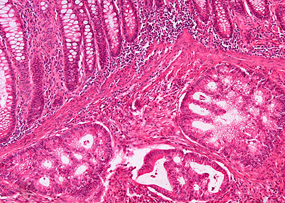 GIJ041105Pathologie2 GIJ041105Pathologie2