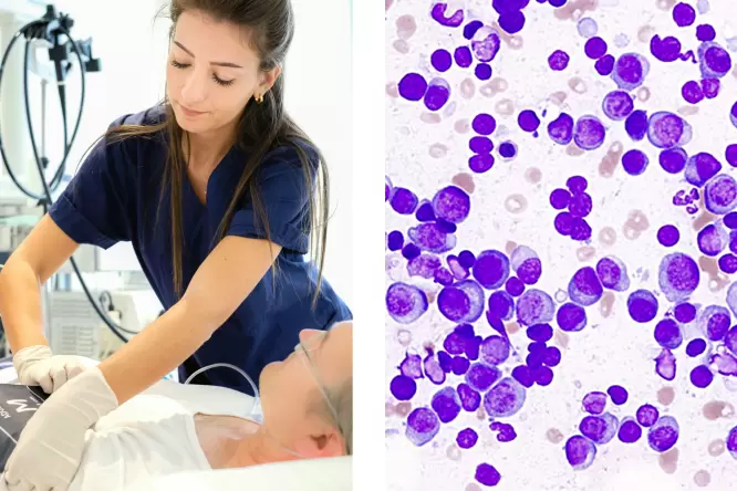 Ärztliche Assistentin bei der Arbeit mit einem Patienten, Abbildung Krebszellen, Dr. med. F. Abedinpour, Onkologie, Gastroenterologie im Josephinum